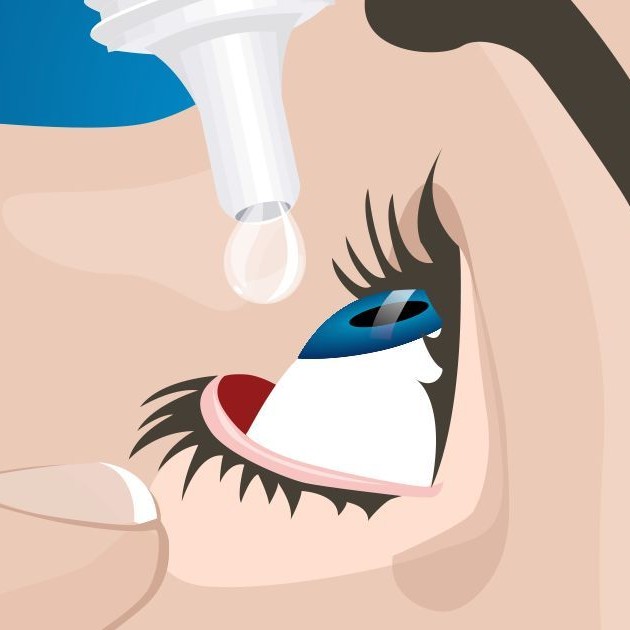 ЛЕЧЕНИЕ ГЛОУКОМЫ