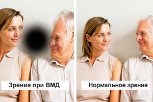 task_01kbdc02refnqsmq17spsmbjd3_1764606760_img_1